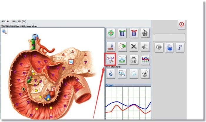 nls diagnostic system