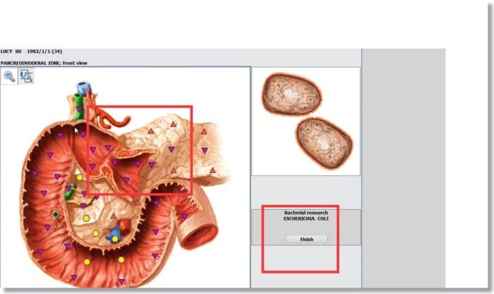 nls diagnostic system